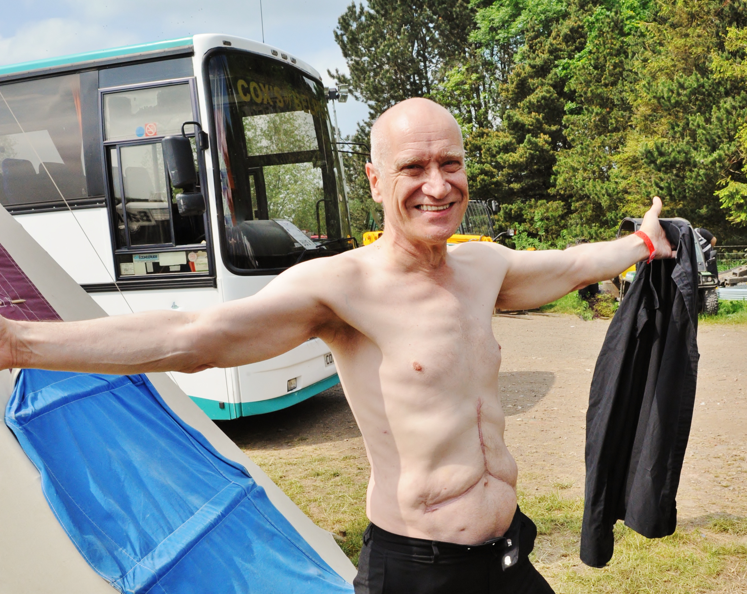 Cancer survivor Wilko Johnson and the "Mercedes" scar from his life-saving surgery - backstage at Bearded Theory Festival (Copyright Simon Redley)
